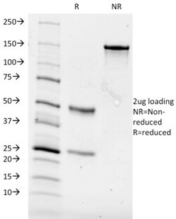 CD84/SLAMF5 Antibody (153-4D9), Novus Biologicals 0.2mg; Unlabeled:Antibodies,